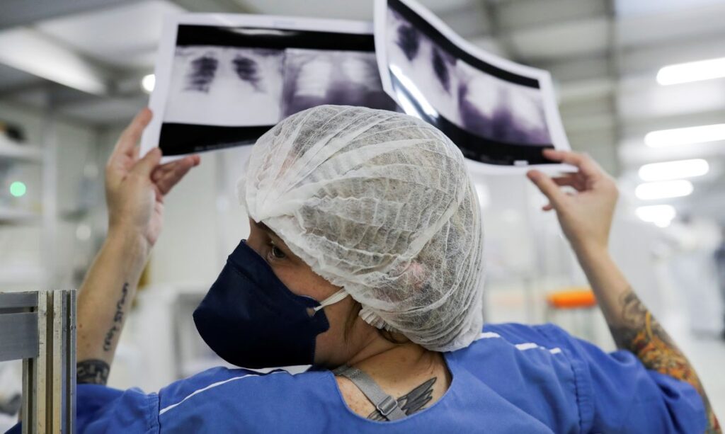 Diagnóstico avançado em 90% dos casos de câncer de pulmão no SUS reduz drasticamente a cura