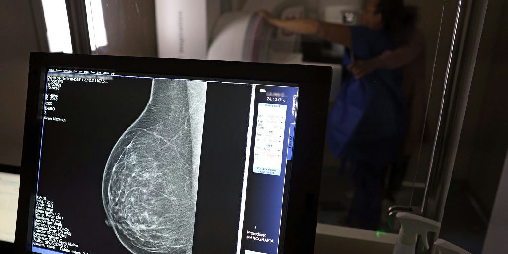 Mamografia digital terá cobertura obrigatória em planos de saúde para todas as idades