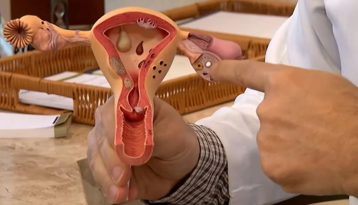 Edital de R$ 60 milhões busca inovações para endometriose e saúde menstrual no SUS