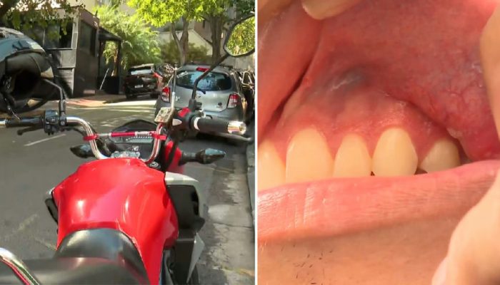 Entregador denuncia agressão física cometida por delegado após atraso em entrega na Grande BH