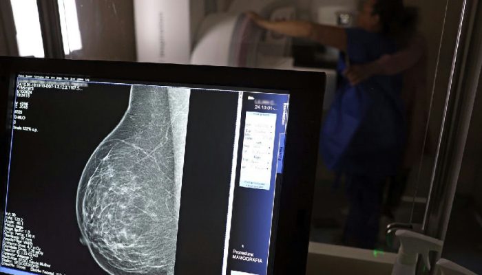 Mamografia digital terá cobertura obrigatória em planos de saúde para todas as idades