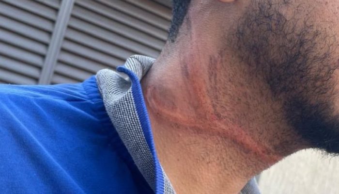 Motociclista sofre ferimentos no pescoço após colisão com fiação solta em Ituiutaba